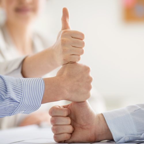 group of business team making thumbs up gesture